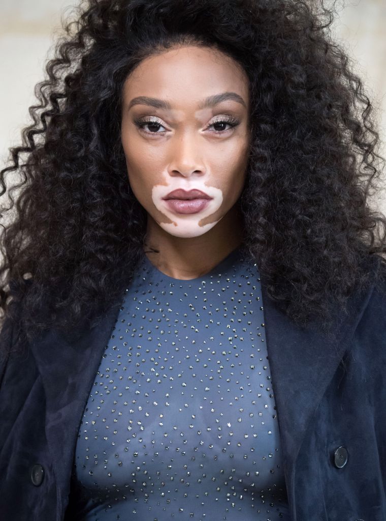 Winnie Harlow
