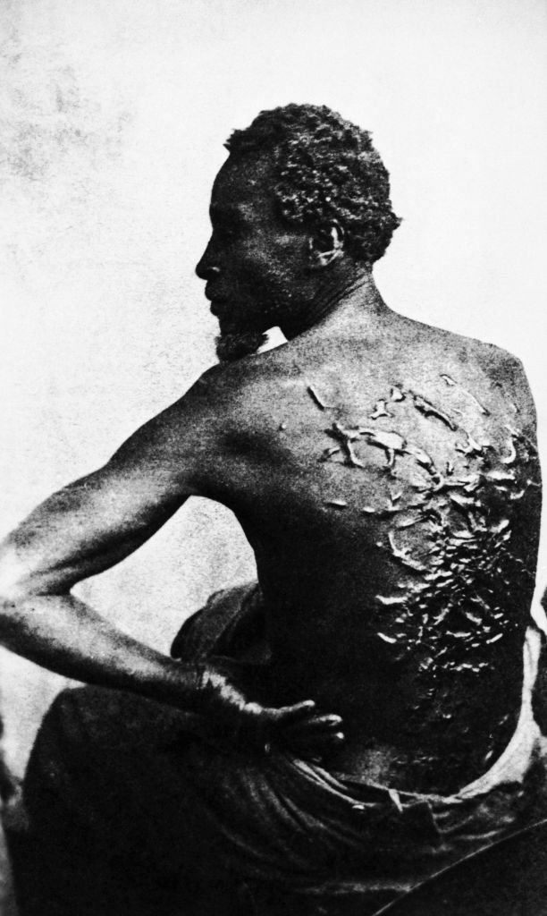 Slave with a Scarred Back